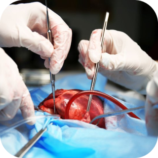 Herztransplantationschirurgie